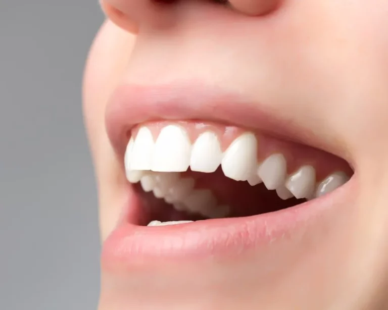sonrisa final gum min 1 768x614
